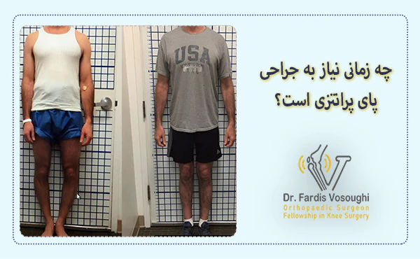 چه زمانی نیاز به جراحی پای پرانتزی است؟