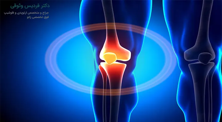 علائم پارگی مینیسک