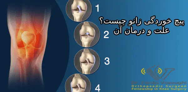 علت پیچ خوردگی زانو
