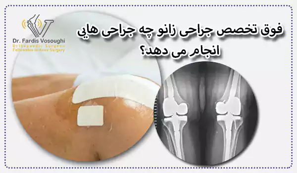 فوق تخصص جراحی زانو چه جراحی هایی انجام می دهد؟