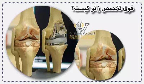 فوق تخصص زانو کیست؟