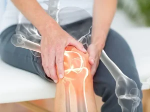 عوارض بی تحرکی بر مفصل زانو