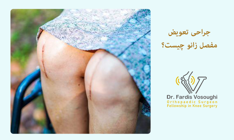 جراحی تعویض مفصل زانو چیست؟ جراحی تعویض مفصل زانو چیست؟