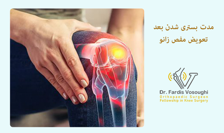 مدت بستری شدن بعد تعویض مفص زانو