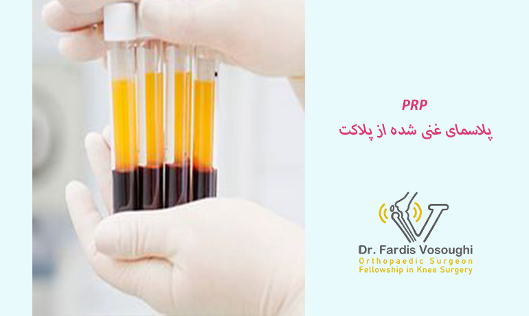 PRP-پی آر پی