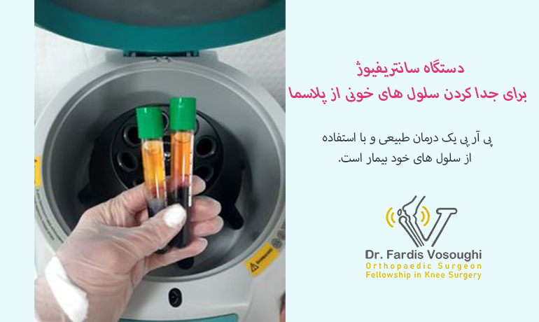 سانتریفیوژ پلاسما