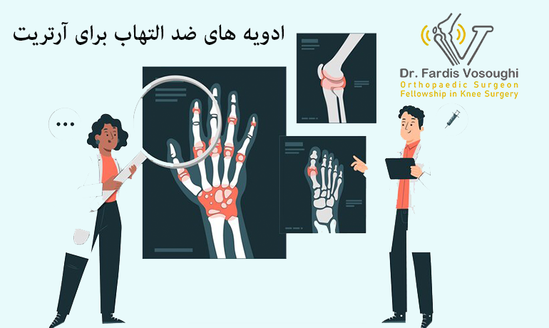 ادویه های ضد التهاب برای آرتریت
