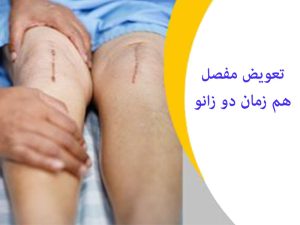 تعویض-مفصل-هم-زمان-دو-زانو
