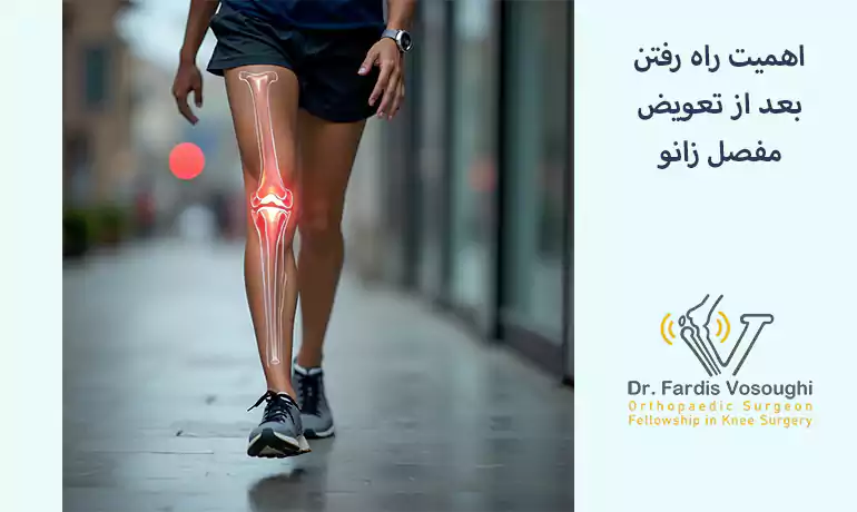 اهمیت راه رفتن بعد از تعویض مفصل زانو