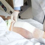 پانسمان-بعد-از-تعویض-مفصل-زانو