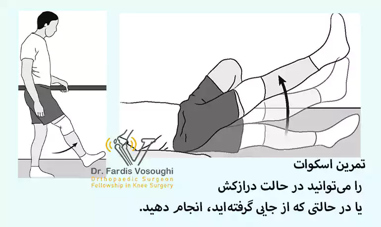 تمرین اسکوات برای راه رفتن بعد از تعویض مفصل زانو