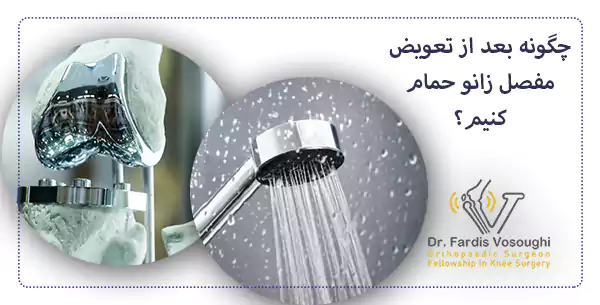 چگونه بعد از تعویض مفصل زانو حمام کنیم؟