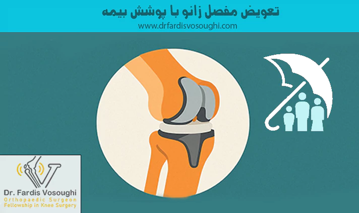 تعویض مفصل زانو با پوشش بیمه