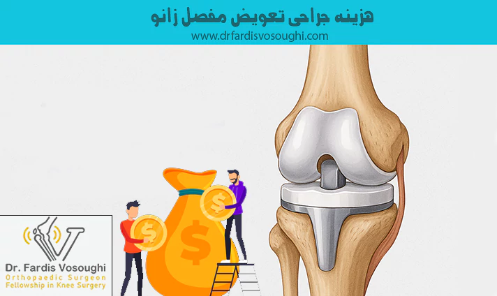 هزینه جراحی تعویض مفصل زانو